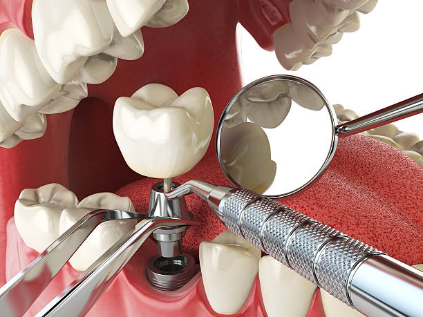 Best Cosmetic Emergency Dentistry in Quail Creek, TX